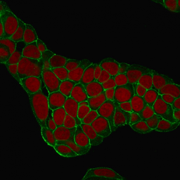 Anti-EpCAM antibody [EGP40/1384] used in Immunocytochemistry/ Immunofluorescence (ICC/IF). GTX34696