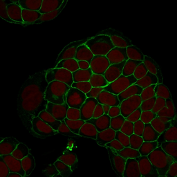 Anti-EpCAM antibody [EGP40/1798] used in Immunocytochemistry/ Immunofluorescence (ICC/IF). GTX34697