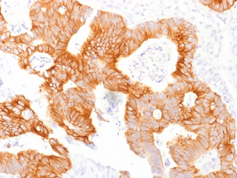 Anti-EpCAM antibody [EGP40/1798] used in IHC (Paraffin sections) (IHC-P). GTX34697