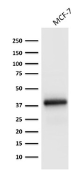 Anti-EpCAM antibody [EGP40/1798] used in Western Blot (WB). GTX34697