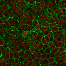 Anti-EpCAM antibody [SPM134] used in Immunocytochemistry/ Immunofluorescence (ICC/IF). GTX34699