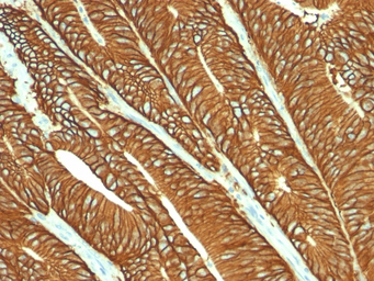 Anti-EpCAM antibody [MOC-31] used in IHC (Paraffin sections) (IHC-P). GTX34700