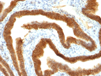 Anti-EpCAM antibody [MOC-31] used in IHC (Paraffin sections) (IHC-P). GTX34700