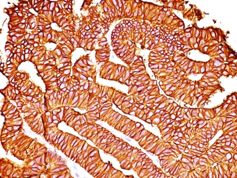 Anti-EpCAM antibody [SPM528] used in IHC (Paraffin sections) (IHC-P). GTX34702