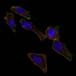 Anti-EpCAM antibody [EGP40/826] used in Immunocytochemistry/ Immunofluorescence (ICC/IF). GTX34704