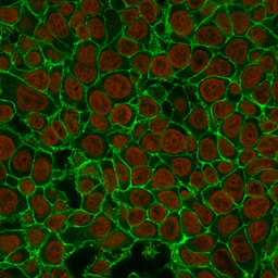 Anti-EpCAM antibody [EGP40/837] used in Immunocytochemistry/ Immunofluorescence (ICC/IF). GTX34705