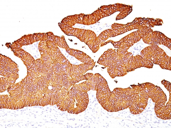 Anti-EpCAM antibody [EGP40/837] used in IHC (Paraffin sections) (IHC-P). GTX34705