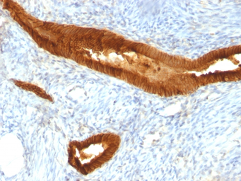 Anti-EpCAM antibody [EGP40/837] used in IHC (Paraffin sections) (IHC-P). GTX34705