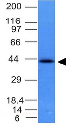 Anti-EpCAM antibody [EGP40/837] used in Western Blot (WB). GTX34705