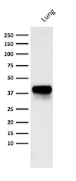 Anti-EpCAM antibody [PAN-EpCAM (Cocktail)] used in Western Blot (WB). GTX34706