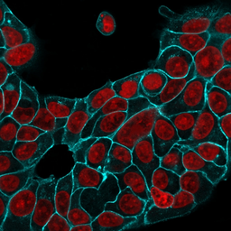 Anti-EpCAM antibody [EGP40/1556R] used in Immunocytochemistry/ Immunofluorescence (ICC/IF). GTX34708