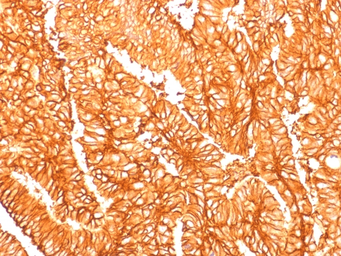 Anti-EpCAM antibody [EGP40/1556R] used in IHC (Paraffin sections) (IHC-P). GTX34708