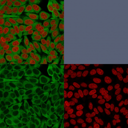 Anti-Fascin 1 antibody [FSCN1/416] used in Immunocytochemistry/ Immunofluorescence (ICC/IF). GTX34717