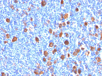 Anti-Fascin 1 antibody [FSCN1/416] used in IHC (Paraffin sections) (IHC-P). GTX34717