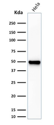 Anti-Fascin 1 antibody [FSCN1/416] used in Western Blot (WB). GTX34717