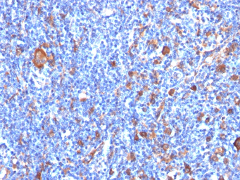 Anti-Fascin 1 antibody [FSCN1/417] used in IHC (Paraffin sections) (IHC-P). GTX34718