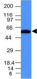 Anti-Fascin 1 antibody [FSCN1/417] used in Western Blot (WB). GTX34718