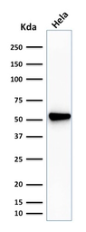 Anti-Fascin 1 antibody [SPM133] used in Western Blot (WB). GTX34719