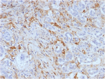 Anti-Ferritin Light Chain antibody [FTL/1388] used in IHC (Paraffin sections) (IHC-P). GTX34723