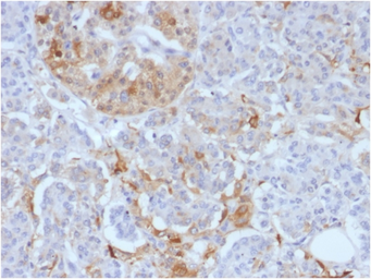 Anti-Ferritin Light Chain antibody [FTL/1388] used in IHC (Paraffin sections) (IHC-P). GTX34723
