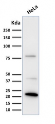 Anti-Ferritin Light Chain antibody [FTL/1388] used in Western Blot (WB). GTX34723