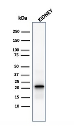Anti-Ferritin Light Chain antibody [FTL/1388] used in Western Blot (WB). GTX34723