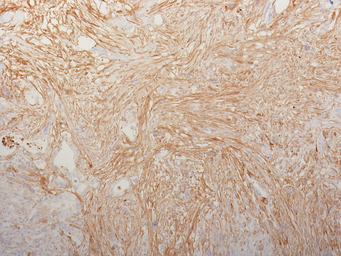 Anti-Fibronectin antibody [HFN7.1] used in IHC (Paraffin sections) (IHC-P). GTX34725