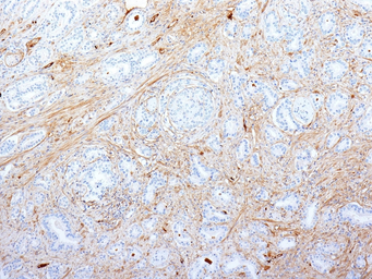 Anti-Fibronectin antibody [SPM539] used in IHC (Paraffin sections) (IHC-P). GTX34726