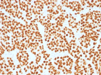 Anti-FOXA1 antibody [FOXA1/1515] used in IHC (Paraffin sections) (IHC-P). GTX34738