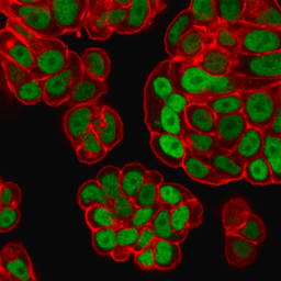 Anti-FOXA1 antibody [FOXA1/1518] used in Immunocytochemistry/ Immunofluorescence (ICC/IF). GTX34739