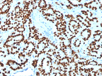 Anti-FOXA1 antibody [FOXA1/1518] used in IHC (Paraffin sections) (IHC-P). GTX34739