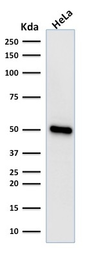 Anti-FOXA1 antibody [FOXA1/1518] used in Western Blot (WB). GTX34739