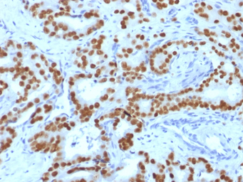 Anti-FOXA1 antibody [FOXA1/1519] used in IHC (Paraffin sections) (IHC-P). GTX34740