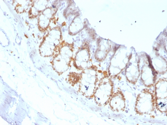 Anti-FOXA1 antibody [FOXA1/1519] used in IHC (Paraffin sections) (IHC-P). GTX34740