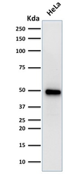 Anti-FOXA1 antibody [FOXA1/1519] used in Western Blot (WB). GTX34740
