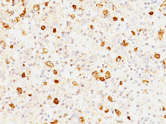 Anti-FSH beta antibody [FSHb/1062] used in IHC (Paraffin sections) (IHC-P). GTX34743