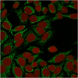 Anti-Galectin 1 antibody [GAL1/1831] used in Immunocytochemistry/ Immunofluorescence (ICC/IF). GTX34746