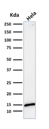 Anti-Galectin 1 antibody [GAL1/1831] used in Western Blot (WB). GTX34746