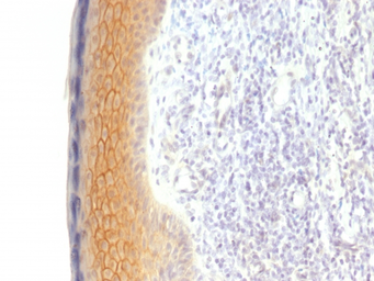 Anti-gamma Catenin antibody [CTNG/1483] used in IHC (Paraffin sections) (IHC-P). GTX34751