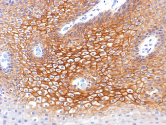 Anti-gamma Catenin antibody [CTNG/1483] used in IHC (Paraffin sections) (IHC-P). GTX34751