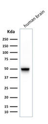 Anti-GFAP antibody [SPM248] used in Western Blot (WB). GTX34756