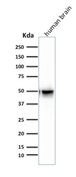 Anti-GFAP antibody [SPM507] used in Western Blot (WB). GTX34757