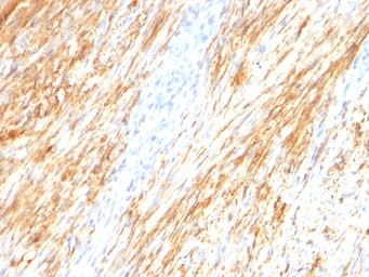 Anti-GFAP antibody [ASTRO/789] used in IHC (Paraffin sections) (IHC-P). GTX34758