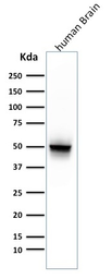 Anti-GFAP antibody [ASTRO/789] used in Western Blot (WB). GTX34758