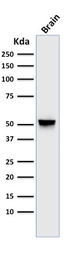 Anti-GFAP antibody [GA-5] used in Western Blot (WB). GTX34759