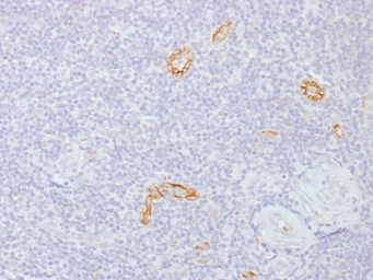 Anti-GJB1 antibody [GJB1/1753] used in IHC (Paraffin sections) (IHC-P). GTX34760