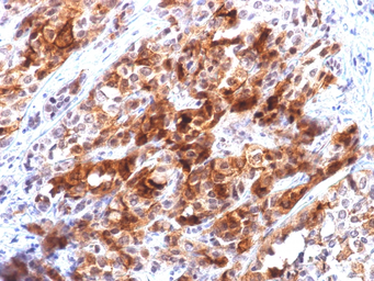 Anti-Glypican-3 antibody [rGPC3/863] used in IHC (Paraffin sections) (IHC-P). GTX34764