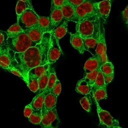 Anti-Glypican-3 antibody [GPC3/1534R] used in Immunocytochemistry/ Immunofluorescence (ICC/IF). GTX34765