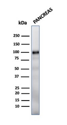 Anti-GP2 antibody [GP2/1712] used in Western Blot (WB). GTX34766