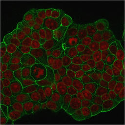 Anti-Her2 / ErbB2 antibody [ERB2/776] used in Immunocytochemistry/ Immunofluorescence (ICC/IF). GTX34781